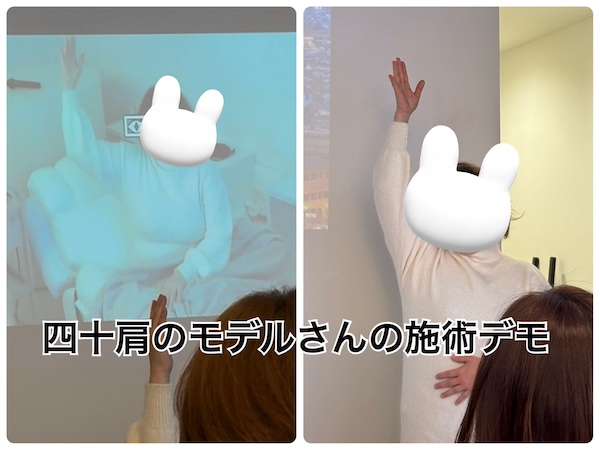 施術デモ